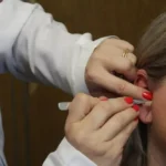 Núcleo de Saúde Mental de Selvíria amplia atendimento com auriculoterapia